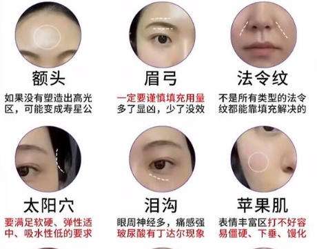 面部填充