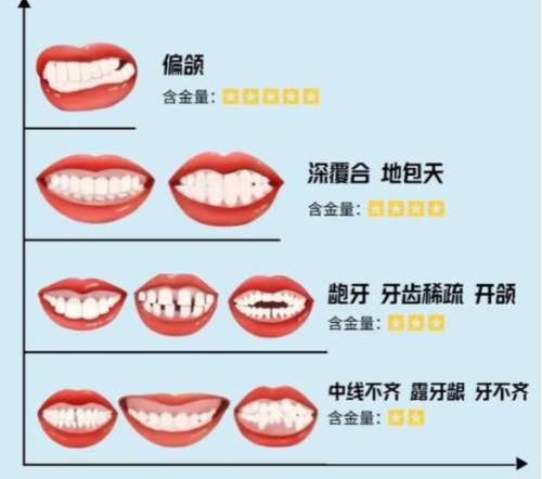 牙齿矫正