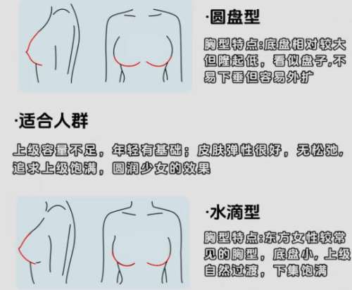 隆胸