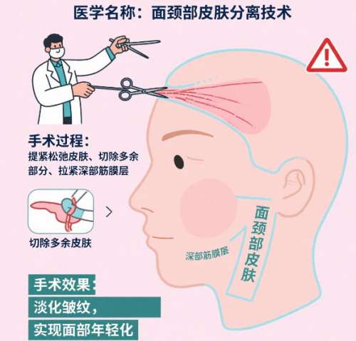 拉皮