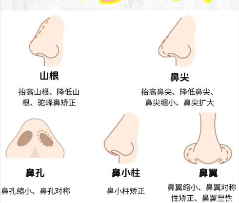 隆鼻