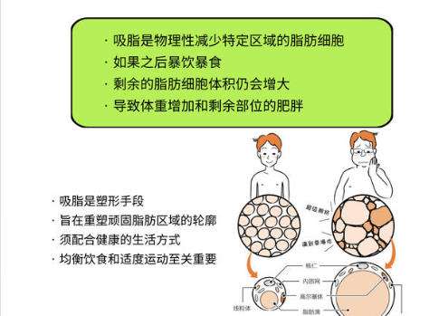 吸脂1.jpg