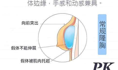丰胸5.jpg