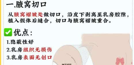 隆胸1.jpg