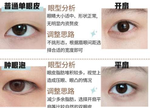 双眼皮3.jpg