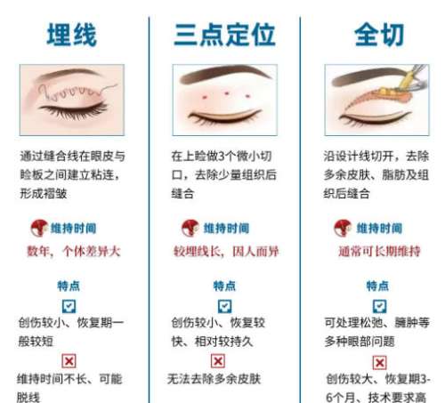 双眼皮1.jpg