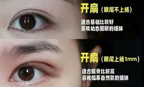 眼整形1.jpg
