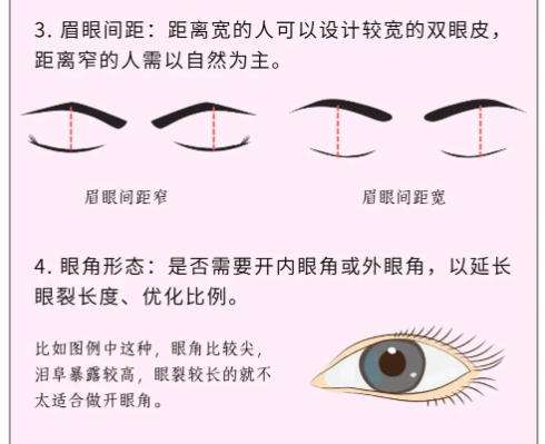 双眼皮