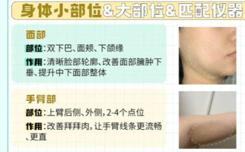 面部吸脂