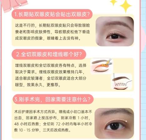 双眼皮