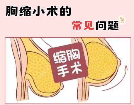 缩胸