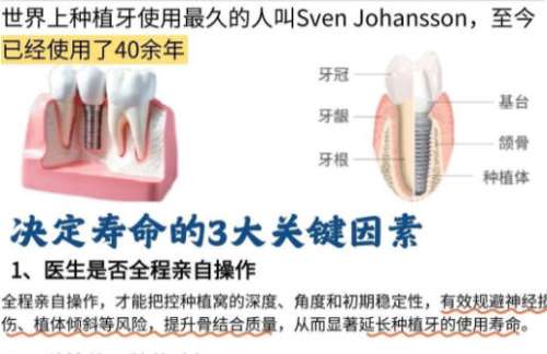 种牙.jpg