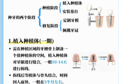 种牙4.jpg