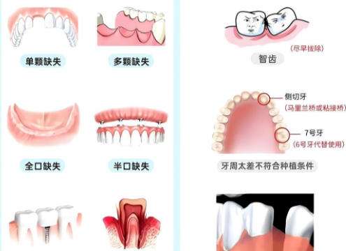 种牙1.jpg