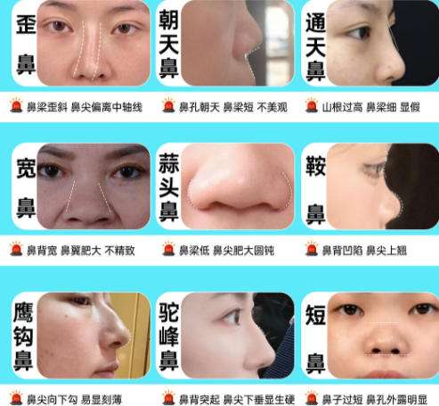 隆鼻2.jpg