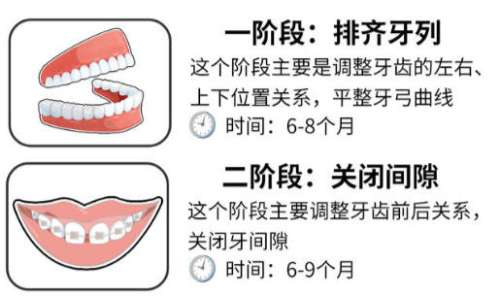 牙齿矫正2.jpg
