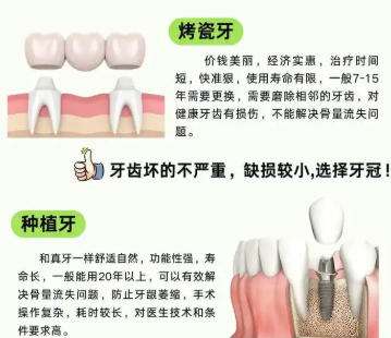 牙齿种植