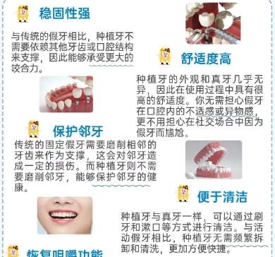 牙齿种植