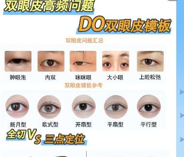 双眼皮