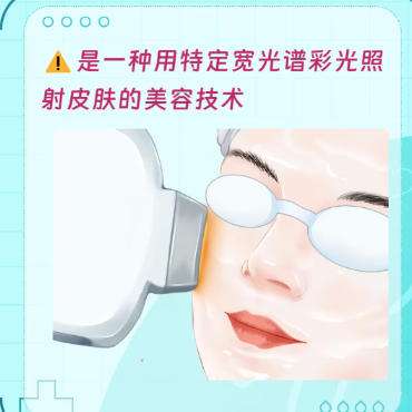 光子嫩肤