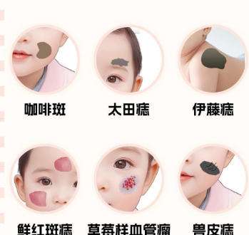 去胎记