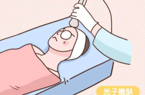 光子嫩肤 光子嫩肤