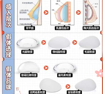 隆胸