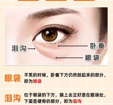 去眼袋