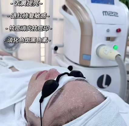 光子嫩肤