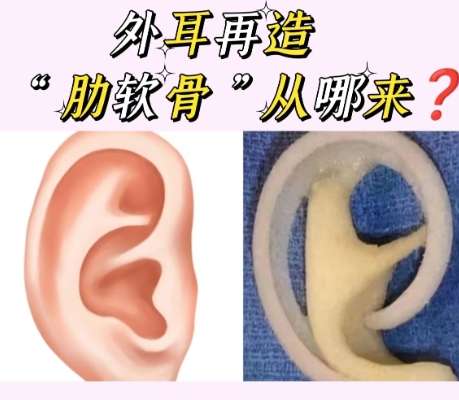 耳朵整形