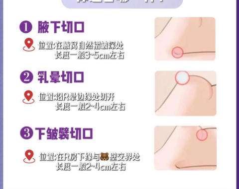隆胸9.jpg