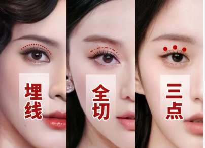 双眼皮
