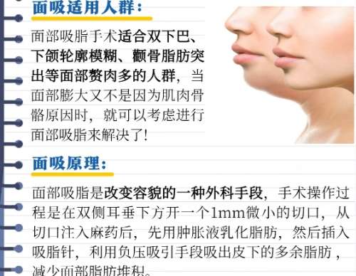 吸脂瘦脸