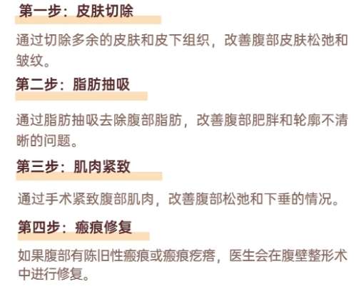 腹壁整形
