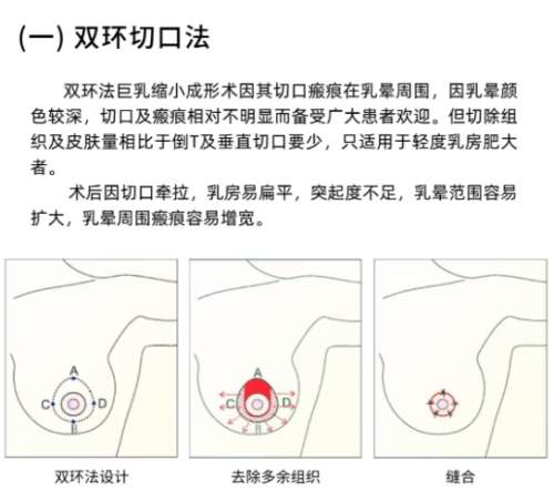 缩胸