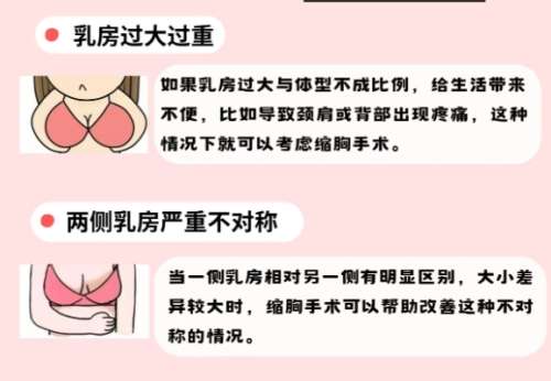 乳房缩小