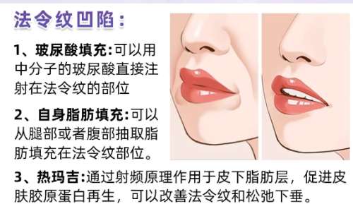 脂肪填充