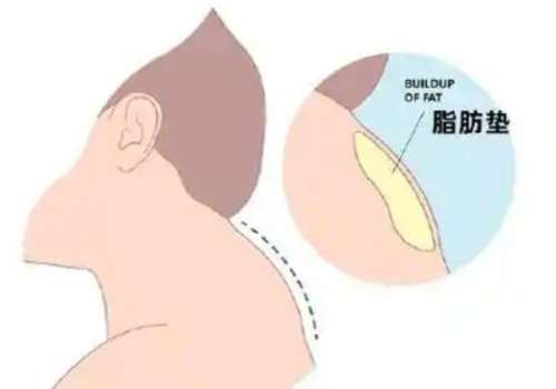 富贵包 富贵包