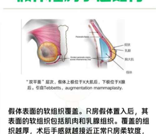 隆胸