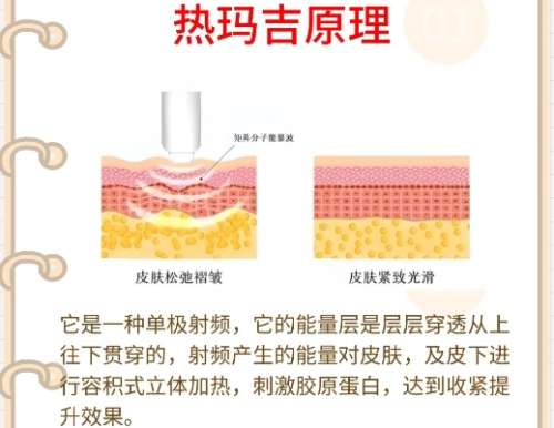 热玛吉