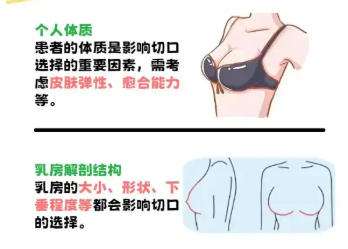 隆胸dmm