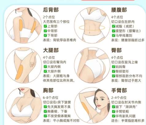 吸脂