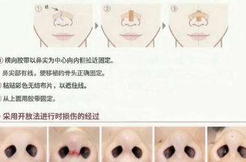 缩鼻头