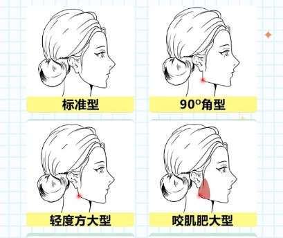 下颌角
