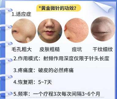 黄金微针