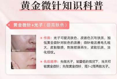 黄金微针