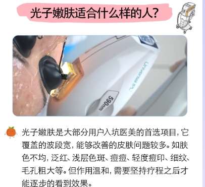 光子嫩肤