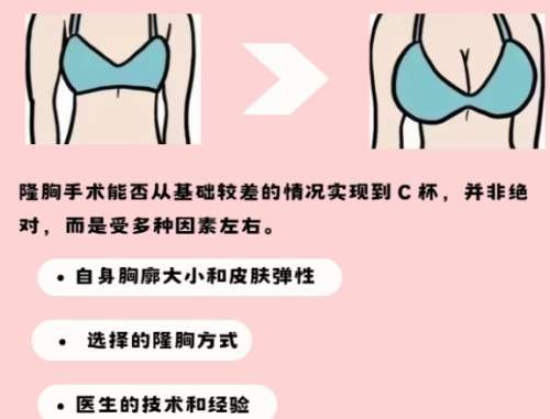 隆胸