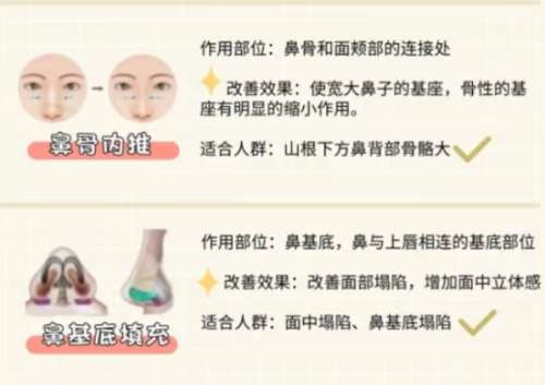 隆鼻知识科普.jpg