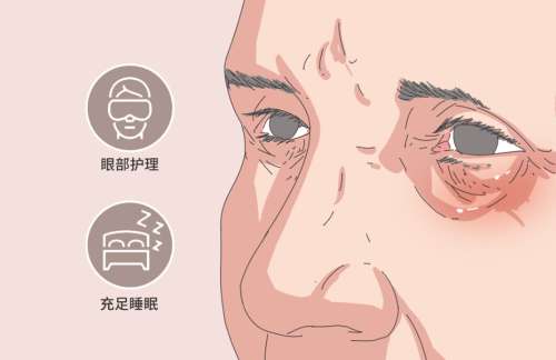 眼袋